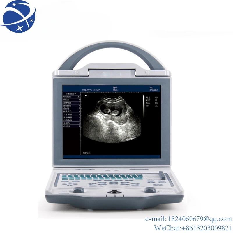 

Doppler ultrasound trolly machine price cheapest screen echography wireless beauty medical equipment suppliers