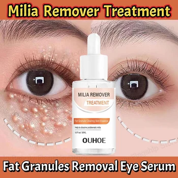 Fat Granules Removal Eye Serum Eye Milia Repair Treatment Products Wrinkle Lifting Moisturizing Anti-Puffiness Korean Skin Care 1