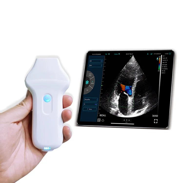 

2021 High quality Medical Ultrasound Instruments Color Doppler Wireless&Usb Phased Array Probe for Cardiac/heart Konted C10UC