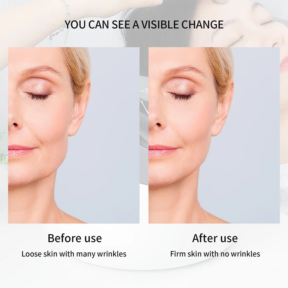 2-IN-1 RF Bipolar Face&Body Lifting Machine 1MHz Radio Frequency Red Light Photon Therapy Anti-Wrinkle Skin Tightening&Slimming