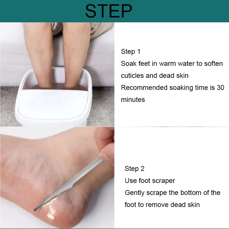 Manicure Pedicure Tools Toe Nail Shaver Feet Pedicure Knife Kit Foot Callus Rasp File Dead Skin Remover Foot Care Tools 2