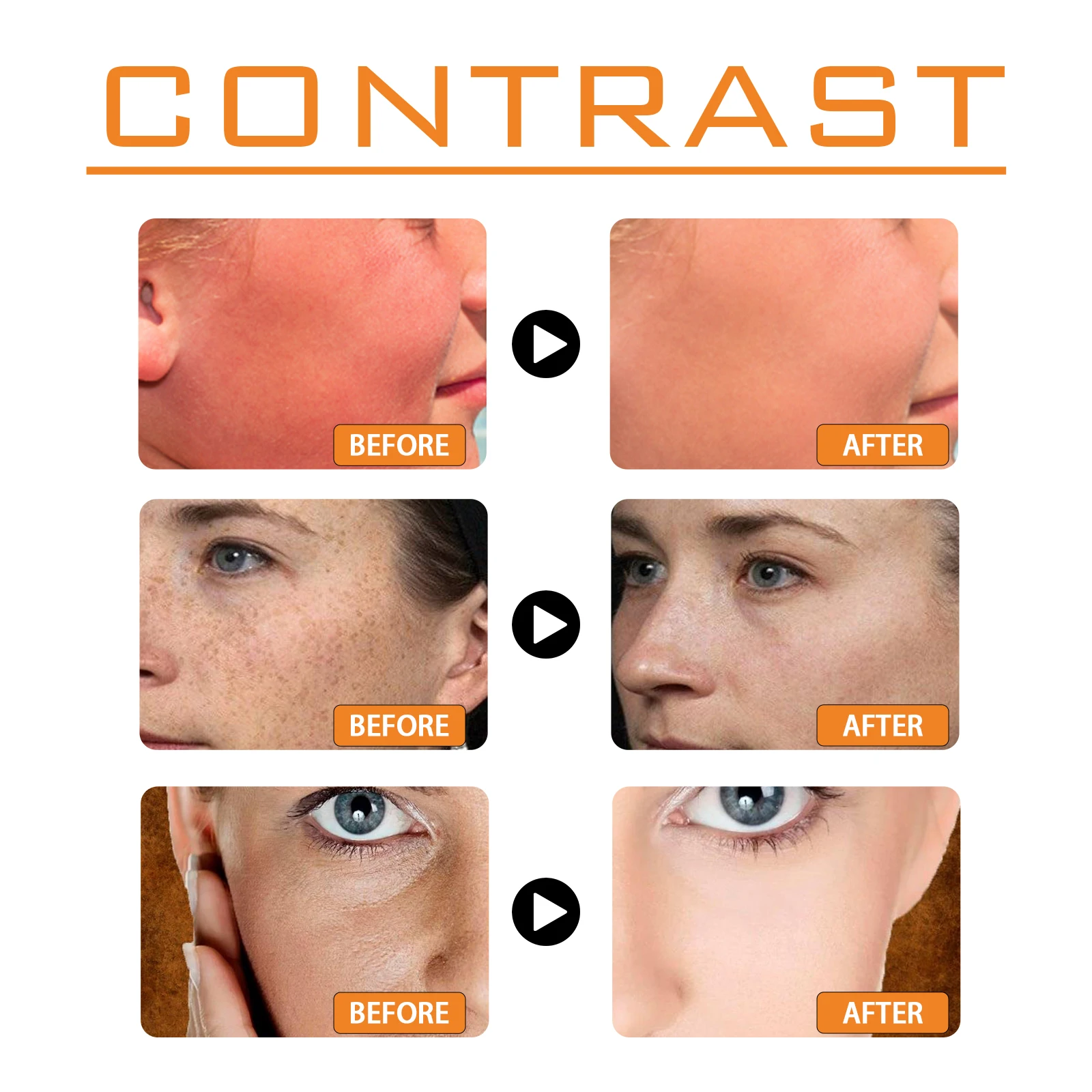Protector solar facial y corporal spf 100 protección uva uvb_voghion.com