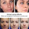 Powerful Dark Spots Remover Whitening Serum Face Freckle Melanin Correcting Anti Pigmentation Brighten Skin Beauty Care Essence 5