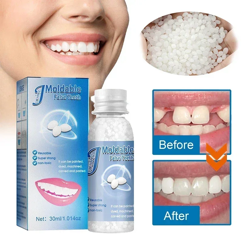 Resin Tooth Repair Glue Shapeable Teeth Gaps Filling Solid Glue Temporary Teeth  Repair Falseteeth Glue Safety Dental Supplies