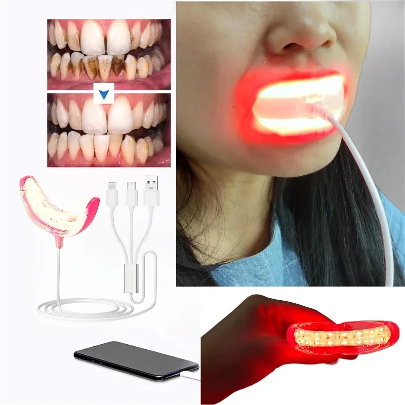 Dental Red Light Therapy Instrument Teeth Pain Cold Sore Canker Treatment Infrared Light for Mouth Oral Physiotherapy Tool