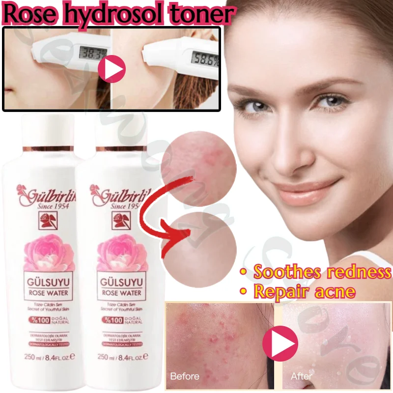 

Damascena Rose Hydrosol Toner Hydrating, Moisturizing, Brightening, Repairing Damage, Relieving Skin Rose Essence Serum Facial