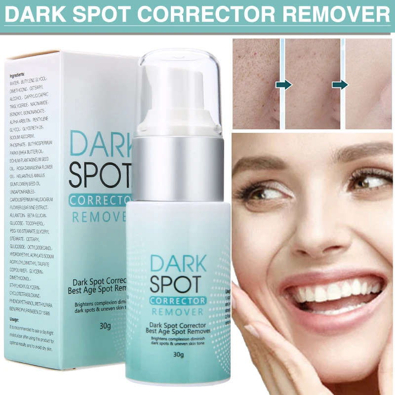 

1 Pc 30g Dark Spot Corrector Remover Whitening Brightening Freckle Anti-Aging Cream for Women Body Face Skin Care Beauty