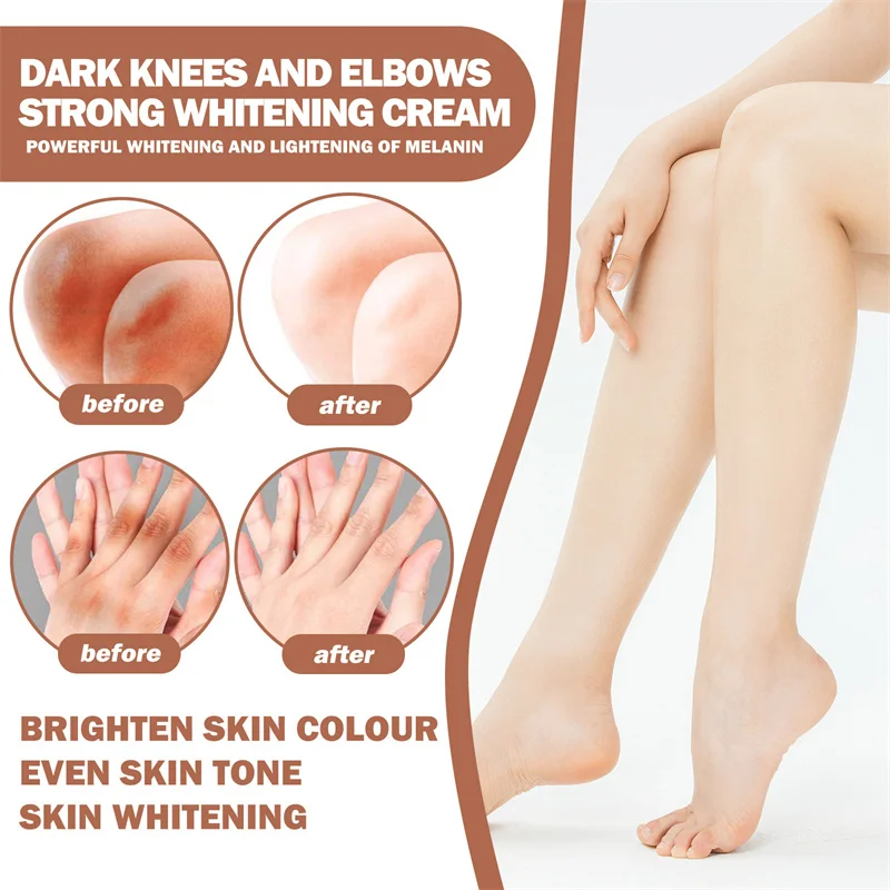 Body Whitening Cream Private Parts Underarm Bleaching Serum Whiten Butt Knee Brighten Inner Thigh Intimate Dark Remove Melanin