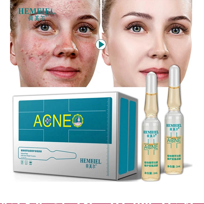 Plant extract acne-removing repair ampoule original solution dilute acne marks acne pits gentle repair skin rejuvenation essence