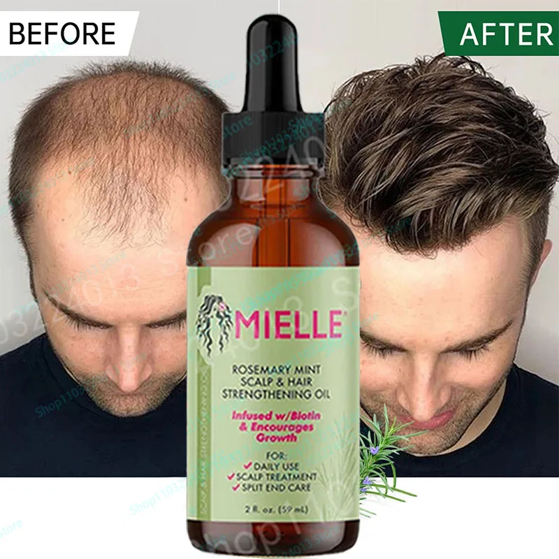 

Mielle Rosemary Mint Hair Oil For Scalp&Hair Strengthening Nourish Improve Split Ends Soothe Dry Scalp Hair Care