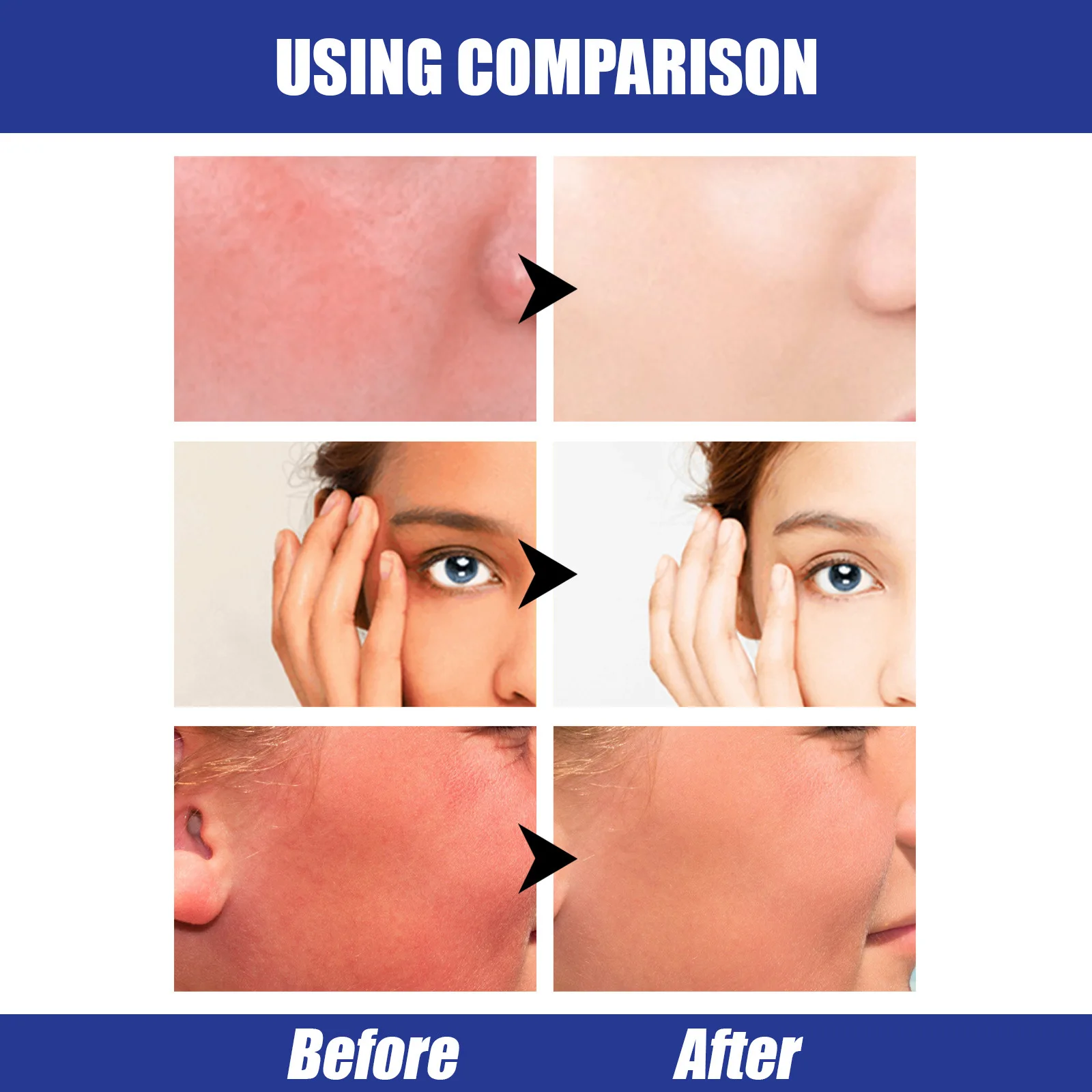 Αντηλιακό Stick UV Protective Cream Spf50 Gel Isolation Lotion Αντιοξειδωτικό Αντιηλιακό Αδιάβροχο λάδι ελέγχου λευκαντική αντηλιακή κρέμα_voghion.com