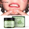 JoyPertty À Base de Plantes Crème De Traitement De L'acné Boutons Enlèvement De Cicatrice Crème Pour Le Visage Huile Contrôle Rétrécir Les Pores Soins De La Peau Beauté Santé