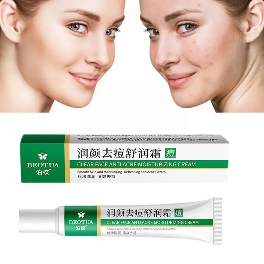 20g Acne Removal Cream Herbal Acne Spots Oil Control Cream Acne Gel