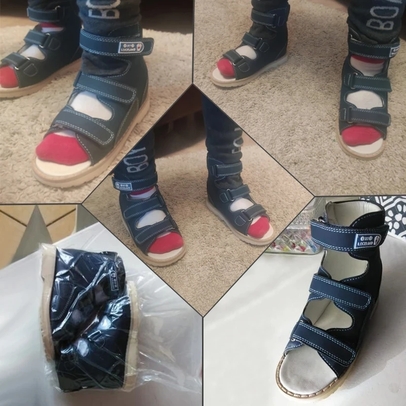 Verão crianças sandália ortopédica para criança do bebê da criança