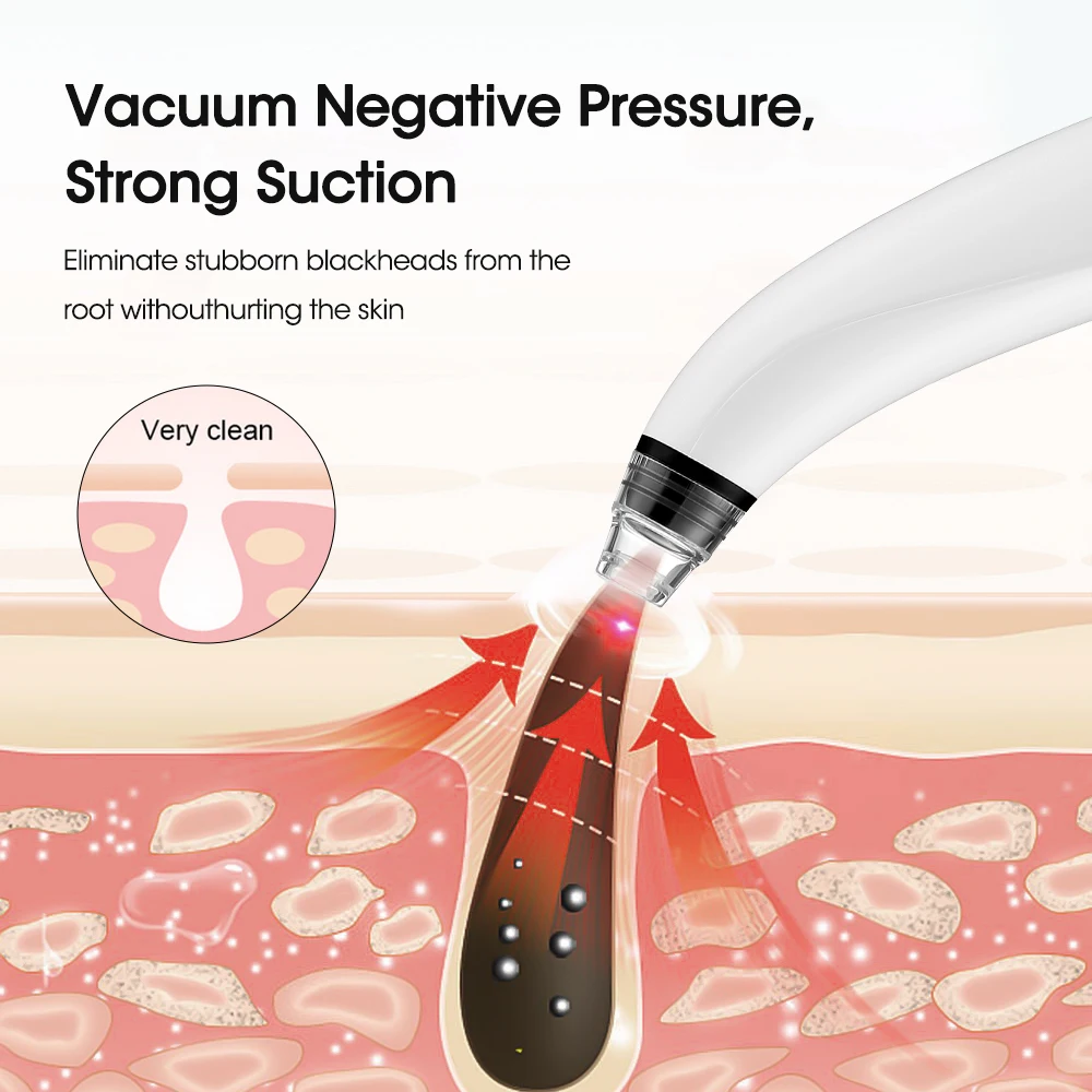 Blackhead Remover Facial Pore Cleanser Acne Remover Visual Facial Cleaner Nose Blackhead Deep Pore Acne Pimple Removal Vacuum Suction Diamond Beauty Tool USB Face Household