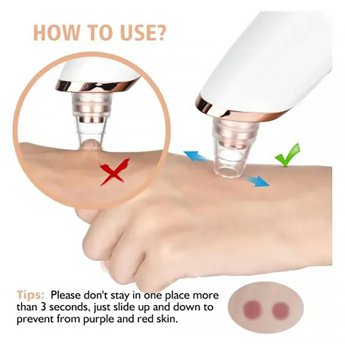 Water Circulation Acne Treatment, Blackhead Extraction Tool.Electric Pore Vacuum Cleaner, USB Rechargeable Blackhead Remover