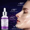 Retinol Aging Removes Wrinkles Serum Pore Shrinking Serum Whitening Moisturizing Serum Pigment Spots Remove Face Firming Oil 6