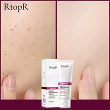 

Skin Care Face Exfoliating Cream Deep Exfoliator Gel Moisturizer Repair Facial Scrub Cleaner Acne Blackhead Remove Face Cream