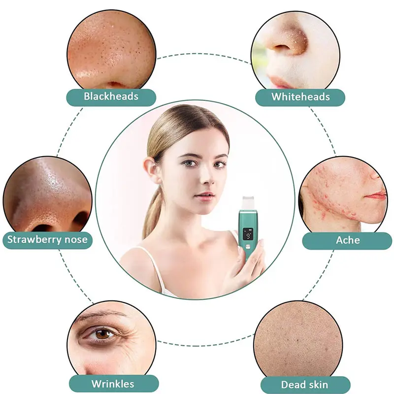 Face Skin Scrubber Blackhead Remover Pore Cleaner Facial Scrubber Spatula EMS Skin Lifting Beauty Device for Deep Cleansing