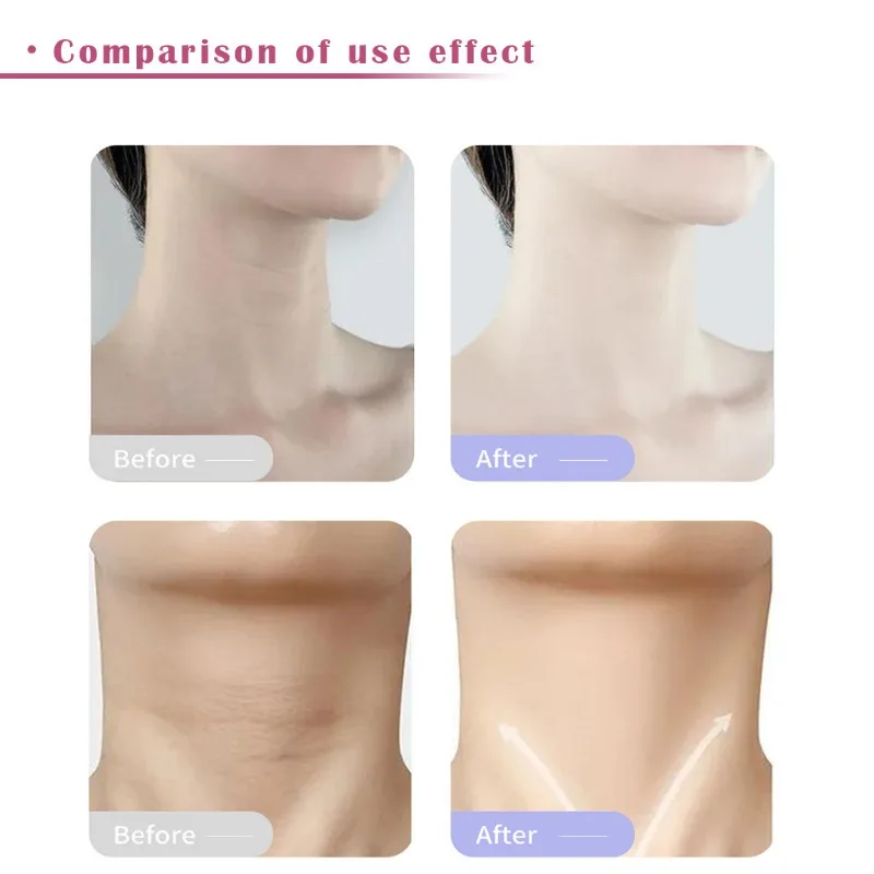 Neck Firming Cream Deeply Hydrates Brightens Lightens Neck Lines Relieves Dry Firming Skin Gently Exfoliates