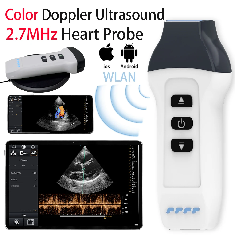 

Wireless Cardiac Probe Color Doppler Ultrasound Veterinary Machine Portable 2.7MHz B-Ultra Scanner For Pig Sheep Dog iOS/Android