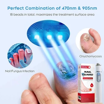 Nail Fungus Laser Device Nail Fungal Treatment Onychomycosis Repair Toenail Nail Remover Pedicure Foot Care Ingrown Fungus 1
