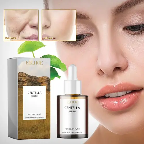 Centella Asiatica Face Serum Nourish Dry Skin Smoothing Rejuvenation Skin Brightening Whitening Cream Facial Moisturizer Korean - Image 3