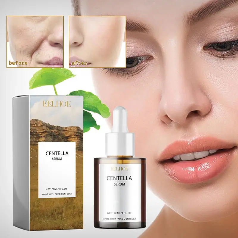 Centella Asiatica Face Serum Nourish Dry Skin Smoothing Rejuvenation Skin Brightening Whitening Cream Facial Moisturizer Korean - Image 3