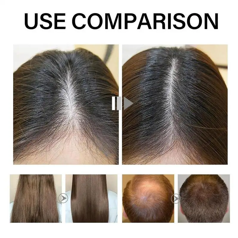 Hair Growth Oil 60ml Hair Thickening Gel Deoxyribose Gel for Growth