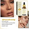 Bee Venom Anti Wrinkle Essence Anti-aging Polypeptide Hyaluronic Acid  Essence Can Repair Moisturize and Tighten Facial Skin 3