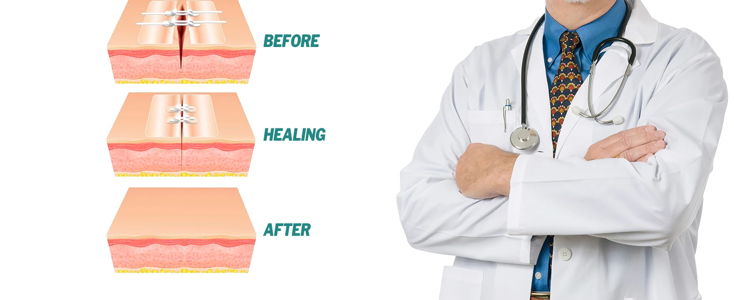 Sanke Rescue Wound Closure Strips - Detail Image 5