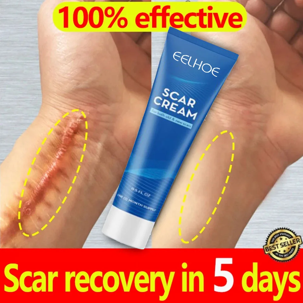 Abera Scar Red Turmeric Cream - Scar Removal Cream - ABERA USA