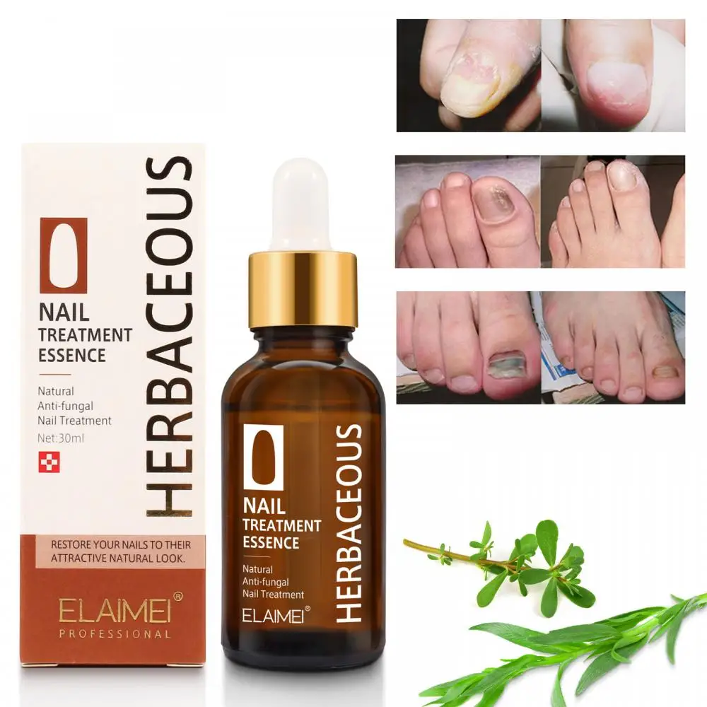 

30ml Nail Care Solution Antibacterial Liquid For Removing Onychomycosis Fungus Removal Nail Oil Moisturizing Care TSLM2