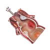 Anatomy Model Human Rectal Hemorrhoid Lesion Model Hemorrhoid Fistula Fistula Fissure Pathology Teaching Model 4