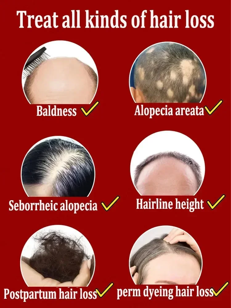 Nick-Hair care beauty, quality of damaged hair, strengthening of the complexion and improvement losses