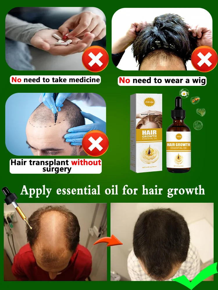 Hair growth essential oil. Effectively repair baldness and hair loss symptoms