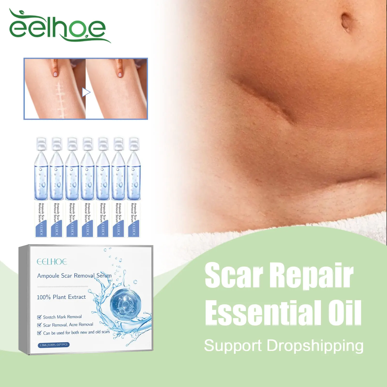 Stretch Mark Removal Essential Oil Pregnancy Lift Maternity Repair Fade Cesarean Section Scald Burn Surgical Scar Health Care