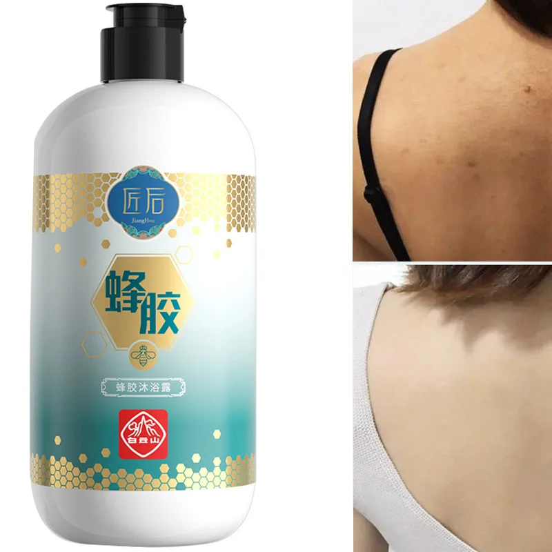 400ml/16.9 OZ Propolis Body Wash Refreshing&Whitening Deep Cleansing&Soothing Skin Moisturizing Remove Chicken Skin Shower Gel body wash