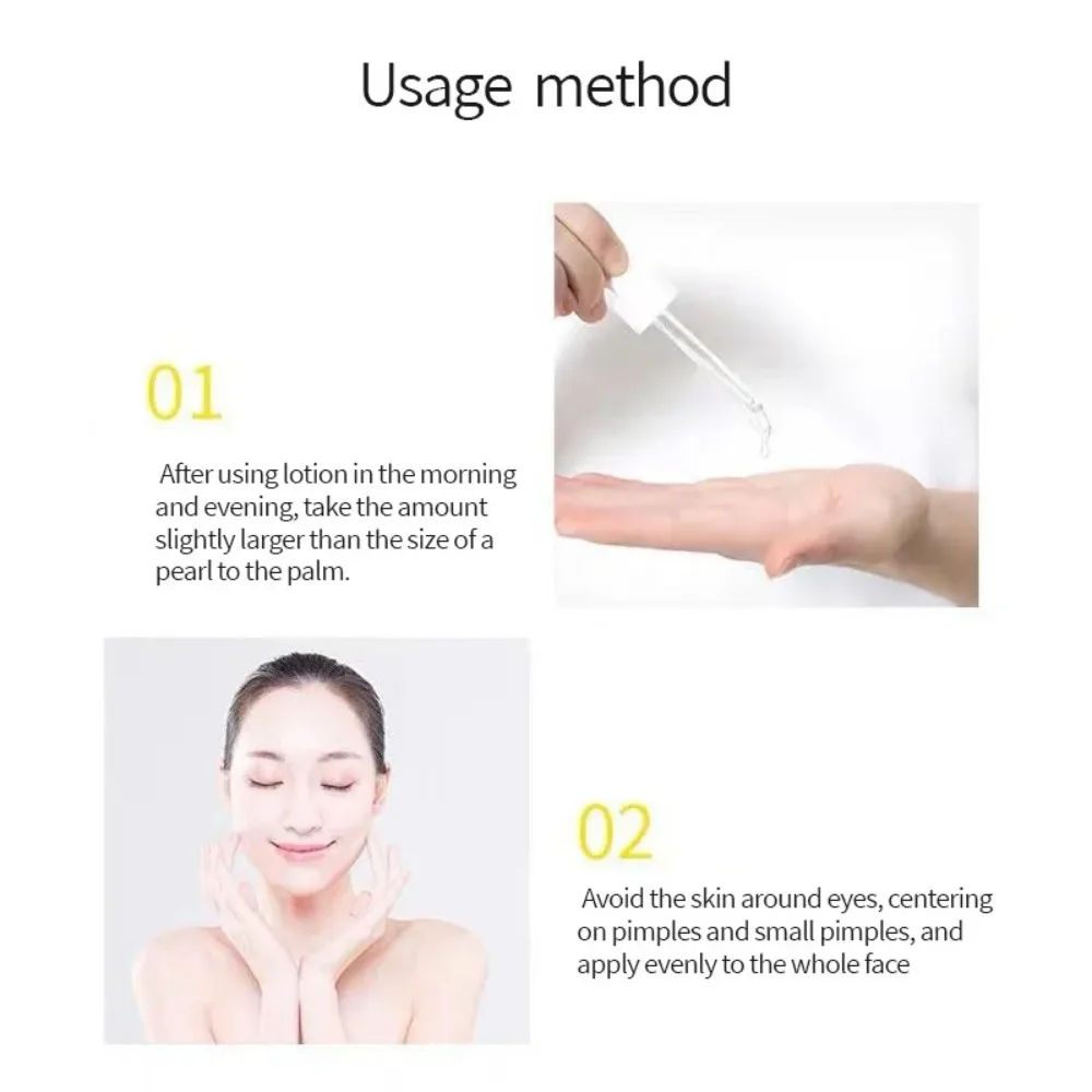 „Garnier Bright Complete“ 30 kartų vitamino C niacinamido serumas, balinantis odos toną, „Essence Fade Acne Mark“ grožio produktai, 30 ml._voghion.com