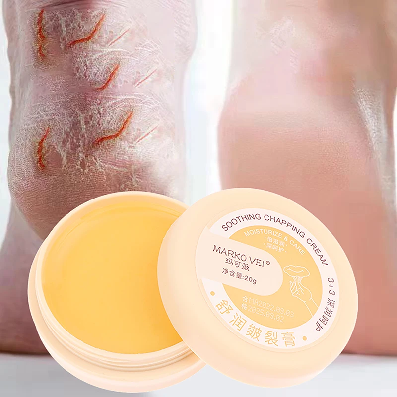 

Hand And Foot Care Cracking Cream Herbal Anti-cracking Heel Treatment Cream Anti-drying Remove Callus Dead Skin Cream Hand Foot