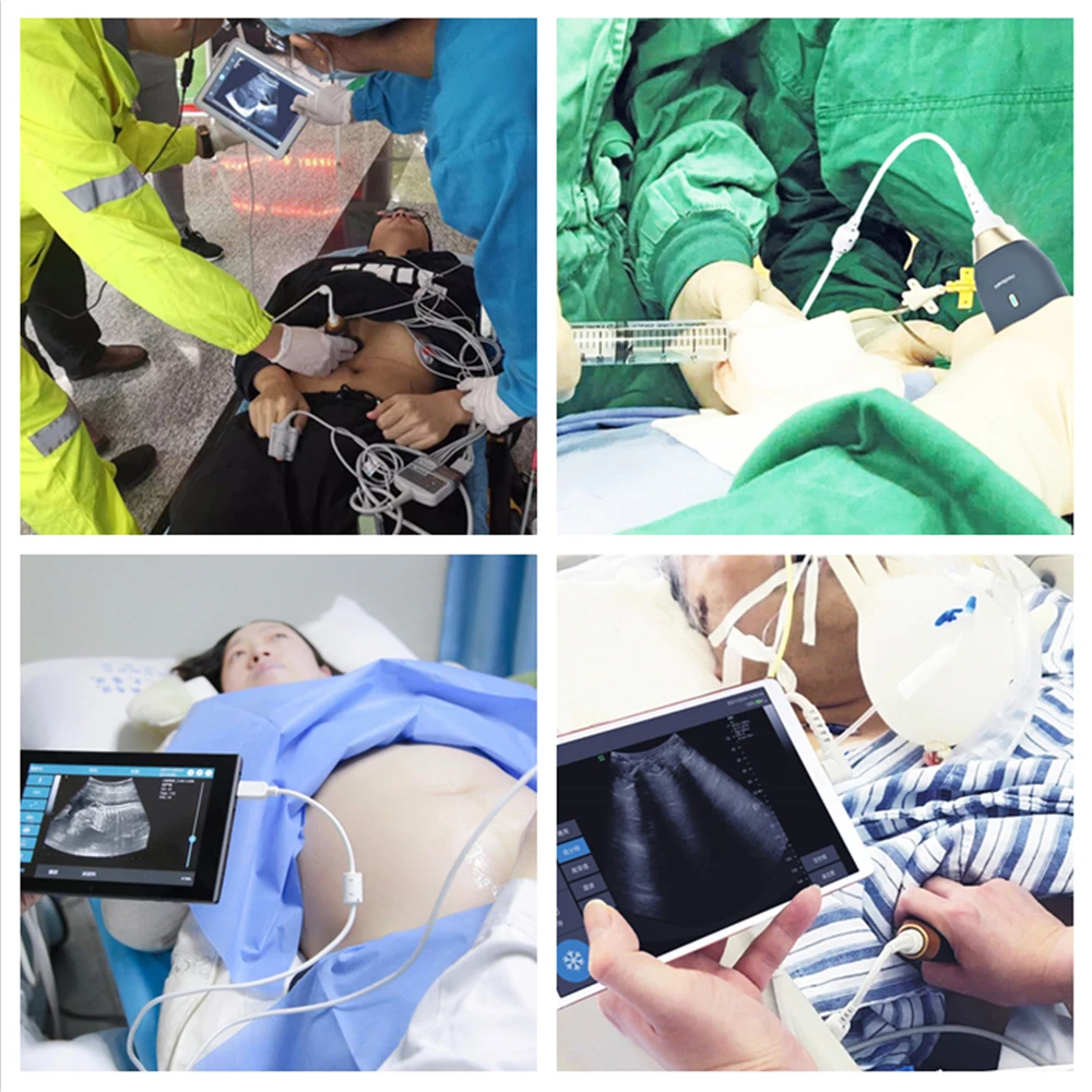 Portable B/W Handheld Linear Scanner Ultrasound Probe Medical Instruments with Android Tablet Computer