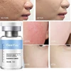 Oligopeptide Placenta Freeze-dried Powder Essence Repair Facial Moisturiz Hydrating Pore Shrinkage Skin Rejuvenation Skin Care 3