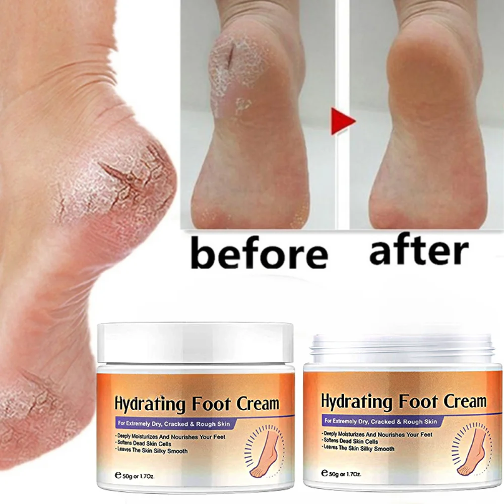 

Cracked Heel Balm Cream for Rough Dry Cracked Chapped Hand/Feet Heel Skin Care Cream Natural Essence Skin Care for Body