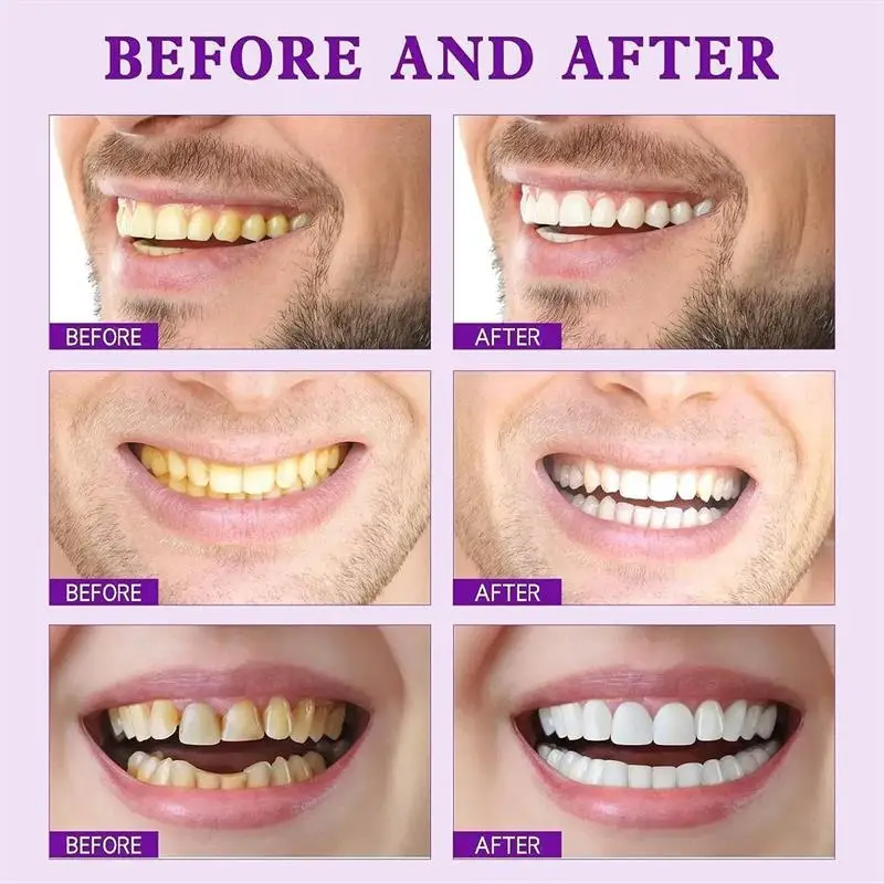 teeth whitening product teeth whitening essence teeth health product SP-7 Toothpaste Oral Health Management Deep Probiotic Whitening Toothpaste Fresh Breath Triple Whitening Teeth Product
