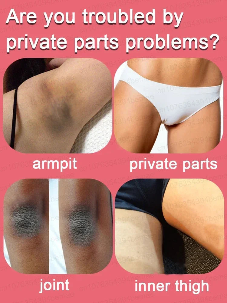Whitening Cream Private Parts Underarm Bleaching Serum Whiten Butt Knee Brighten Inner Thigh Intimate Parts Dark Remove Melanin