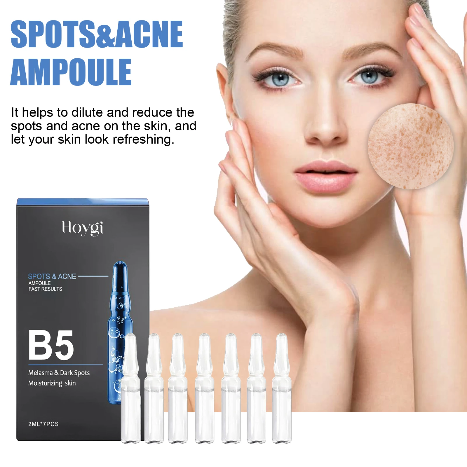 Hoygi Fast Results Dilute Reduce Spots And Acne Refreshing B5 Melasma & Dark Spots Moisturizing Skin Spots & Acne Ampoule 4