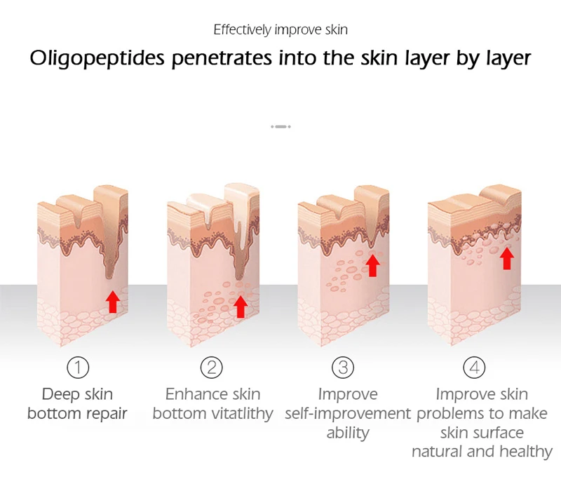 Oligopeptide-1 Face Serum Epidermal Growth Factor Skin Repair Reduce Hyperigmentation MTS Treatment Scar Remove facial serum facial essence