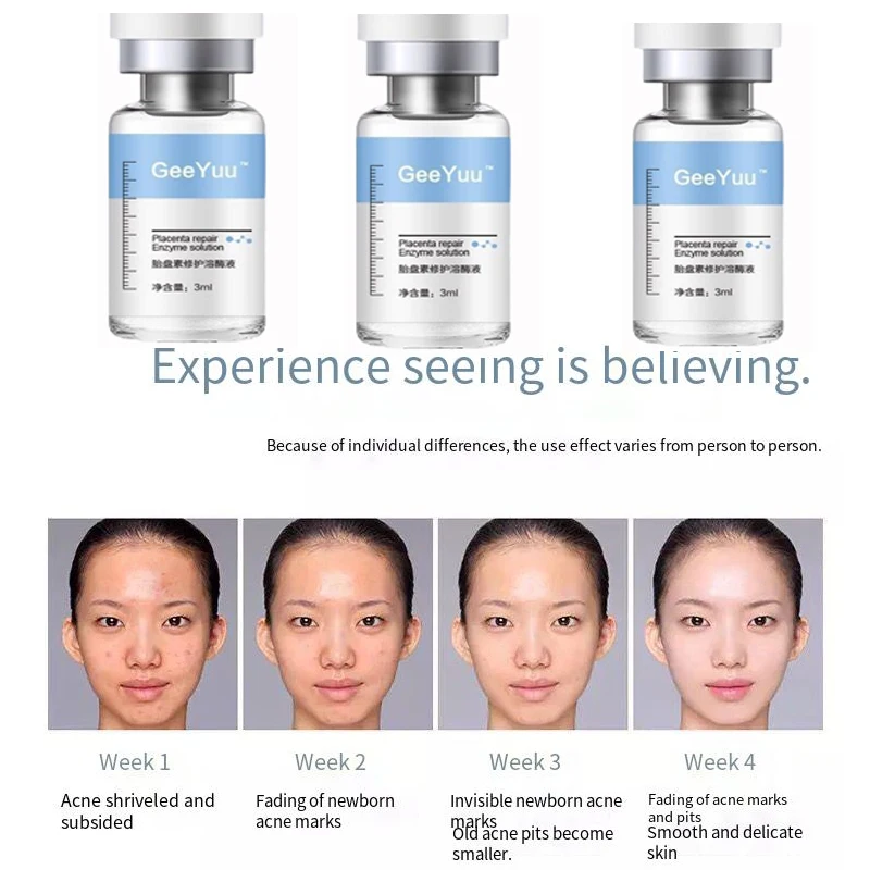 Oligopeptide Placenta Freeze-dried Powder Essence Repair Facial Moisturiz Hydrating Pore Shrinkage Skin Rejuvenation Skin Care 5
