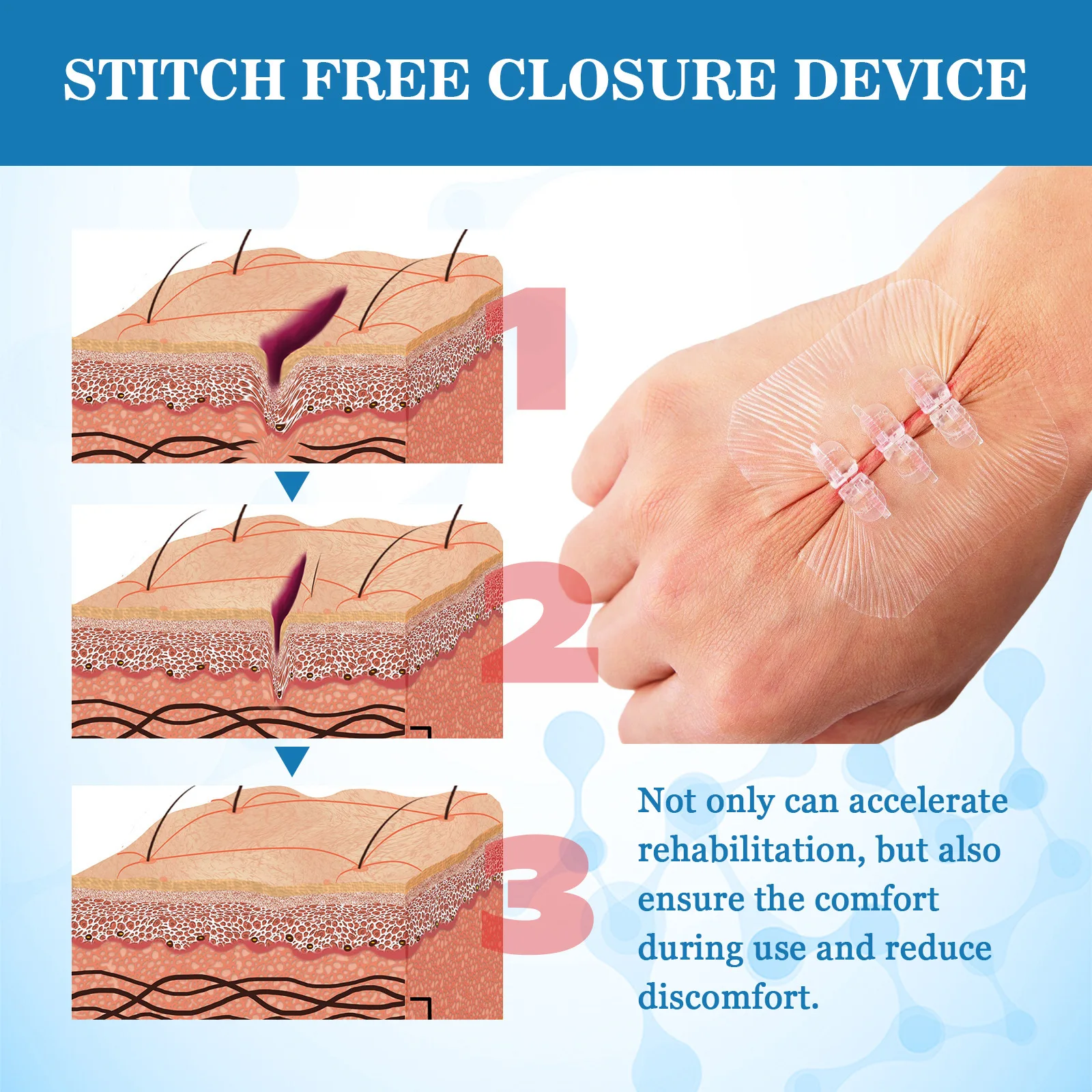 South Moon Portable Wound Closure Patch Painless Suture Zipper Band-Aid Repair Wounds Waterproof Stitch Free Hemostatic Sticker