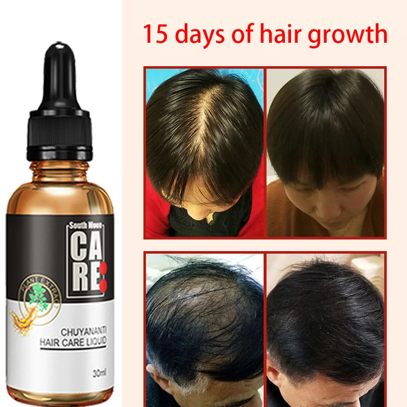 

Hair Nutrient Solution Hair Nourishing Root Hair Nourishing Solution Anti shedding essence